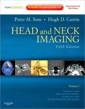 Head and Neck Imaging, 2-Volume Set, 5e - Image 4