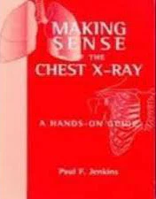 Making Sense of the Chest X-ray : A hands-on guide** - Image 22