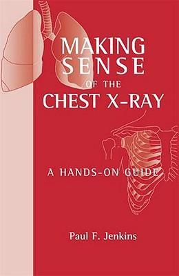 Making Sense of the Chest X-ray : A hands-on guide** - Image 33
