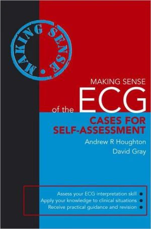Making Sense of the ECG: Cases for Self-assessment** - Image 16