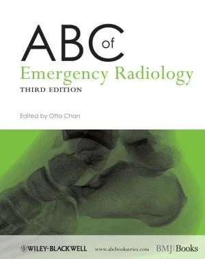 ABC of Emergency Radiology, 3e - Image 16