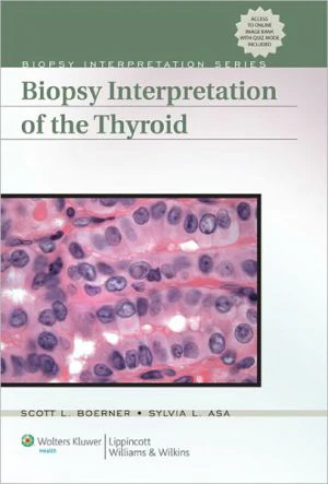 Biopsy Interpretation of the Thyroid** - Image 4