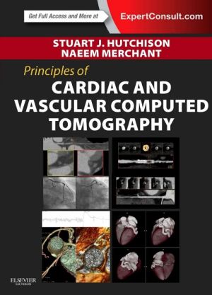 Principles of Cardiac and Vascular Computed Tomography** - Image 4