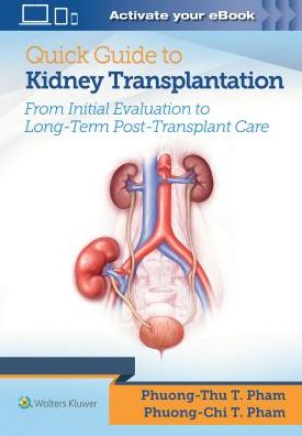 Quick Guide to Kidney Transplantation - Image 4