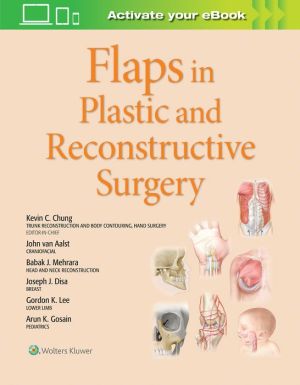 Flaps in Plastic and Reconstructive Surgery - Image 43