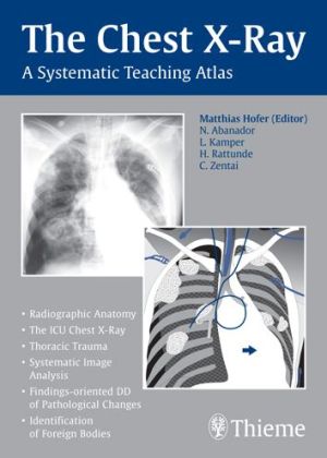 The Chest X-Ray: A Systematic Teaching Atlas - Image 16